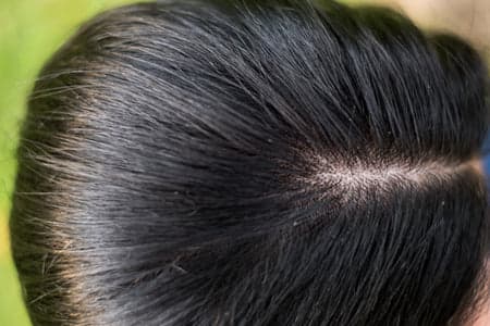 cheveux gras superbon